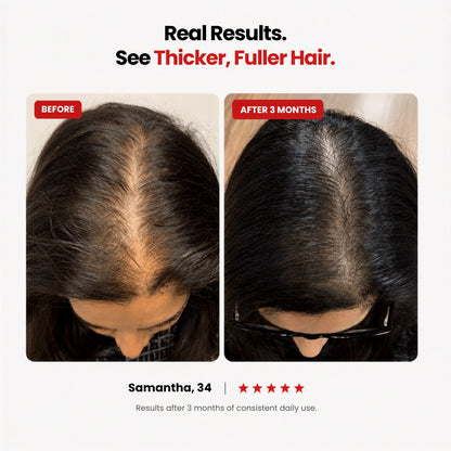 Hair Support Gummies