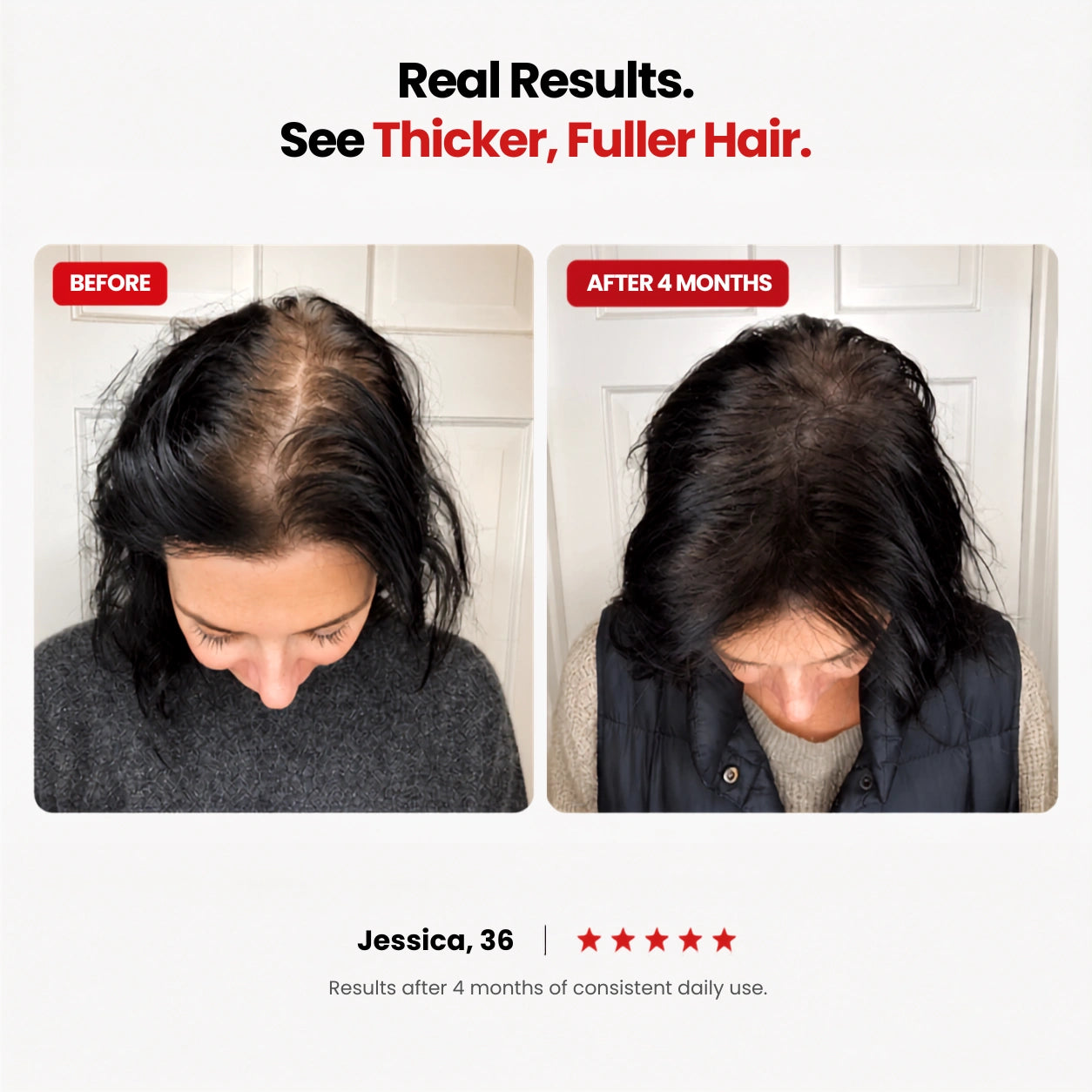 Hair Support Gummies