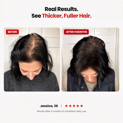 Hair Support Gummies