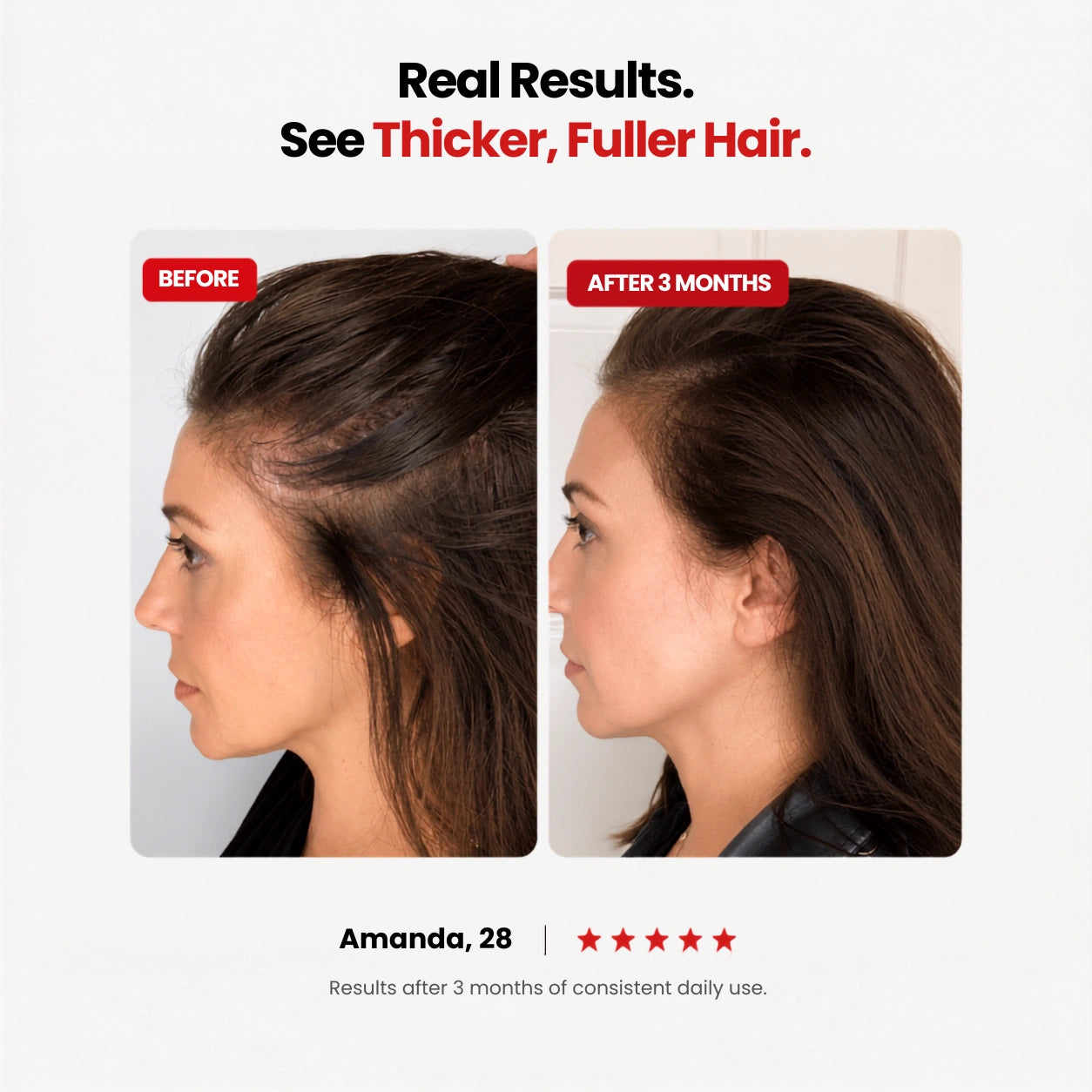 Hair Support Gummies